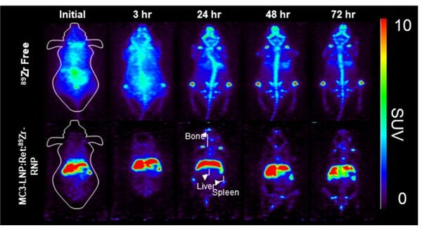 지르코늄-89(89Zr)와 합성한 크리스퍼 단백질이 간경화 질환을 가진 실험용 쥐에 투여되어 72시간동안 추적한 PET 영상자료.